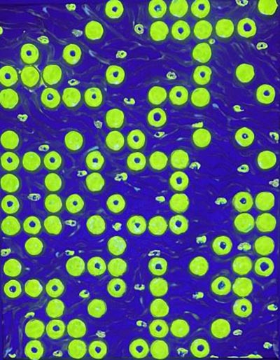 Bright green round dots, mixed with ring-like shapes, are arranged in a random geometric pattern. Organic lines fill the spaces. all set against a purple-blue background.